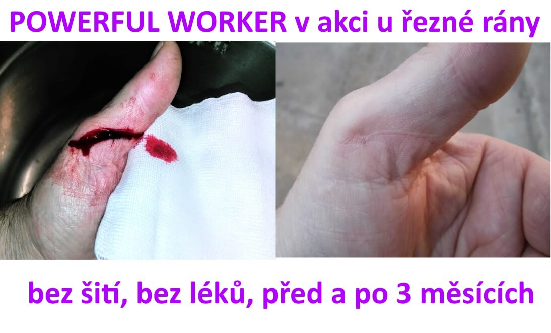 Zdravotní komplikace