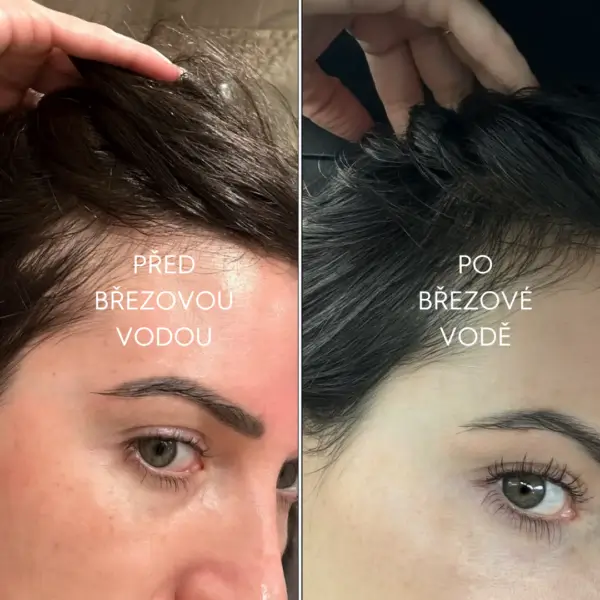 BŘEZOVÁ VODA na VLASY Voono - bezoplachová vlasová voda pro zdravé a lesklé vlasy | 200 ml